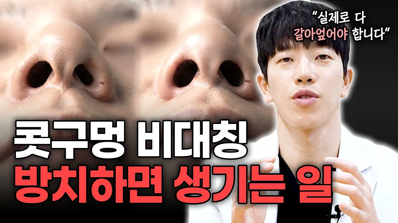 코수술 후 콧구멍 비대칭 방치하면 생기는일 😱ㅣ디에이성형외과