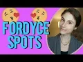 Fordyce spots Q A with dermatologist Dr Dray