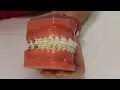 Triangle elastics