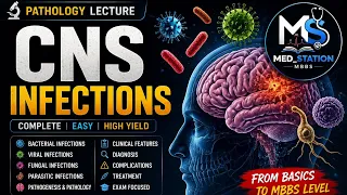CNS Infections MADE EASY Complete Pathology Lecture MBBS Block 11 UHS