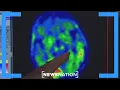 Download Lagu Lithium may reverse Alzheimer’s disease: Study | Elizabeth Vargas Reports