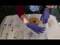 Wound Care 101