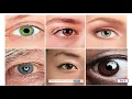 Unit 3 Lesson 7 Vision and the Parts of the Eye