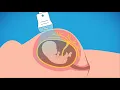 Advanced prenatal genetic testing