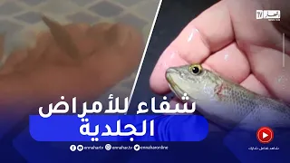 سعيدة عضات سمك التيلابيا علاج للأمراض الجلدية بحمام عين السخونة  سعيدة عضات سمك التيلابيا علاج للأمراض الجلدية بحمام عين السخونة