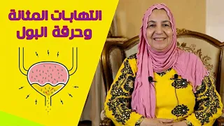 مشروب قوي وفعال للالتهابات الحادة المسالك البولية والمثانة مع كل معاناتها