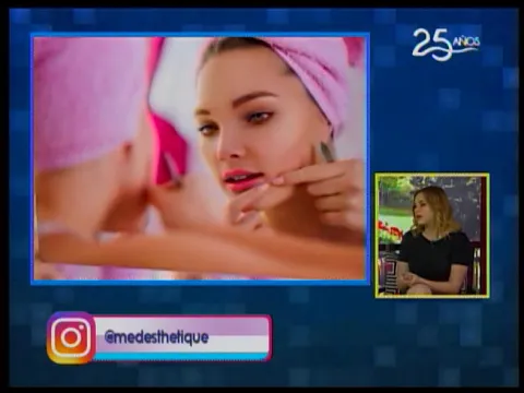 Tratamientos contra el acné 