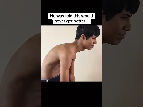 He Was Told Nothing Could Fix This… #beforeandafter #chiropractic
