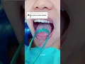 Download Lagu How to  clean your tongue: #askthedentist