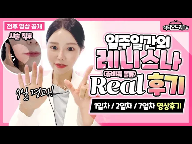 닥터오드리의 셀프시술 후기 : 콜라겐생성필러 쥬베룩볼륨 = 레니스나 받은 후 1일차, 2일차, 7일차 결과보고! 과연 얼굴이 어떻게 변했을까요?