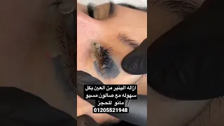 ازاله وشم العين مع صالون مسيو مانو للحجز 01205521948 