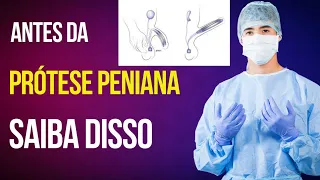 5 Curiosidades sobre Prótese Peniana