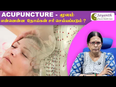 அக்குபஞ்சர் மூலம் குணமாகும் நோய்கள் என்னென்ன தெரியுமா? | மூட்டு வலி முதல் மனஅழுத்தம் வரை!!!