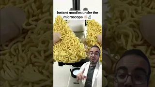 فحص الاندومي تحت الميكروسكوب و النتيجة كانت صدمة    الاندومي تحت المجهر دندنها