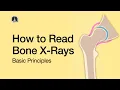 How to Read Bone X-Rays