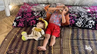 الطفلة جمالات ضبان (3 سنوات) تنتظر تركيب طرف صناعي بعد بتر ساقها بقصف إسرائيلي شمال غزة
