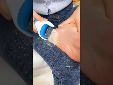 Tool Items - Dead Skin Remover Bath Sponge