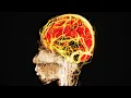 A Girl Ate 96 Gummy Edibles This Is What Happened To Her Brain