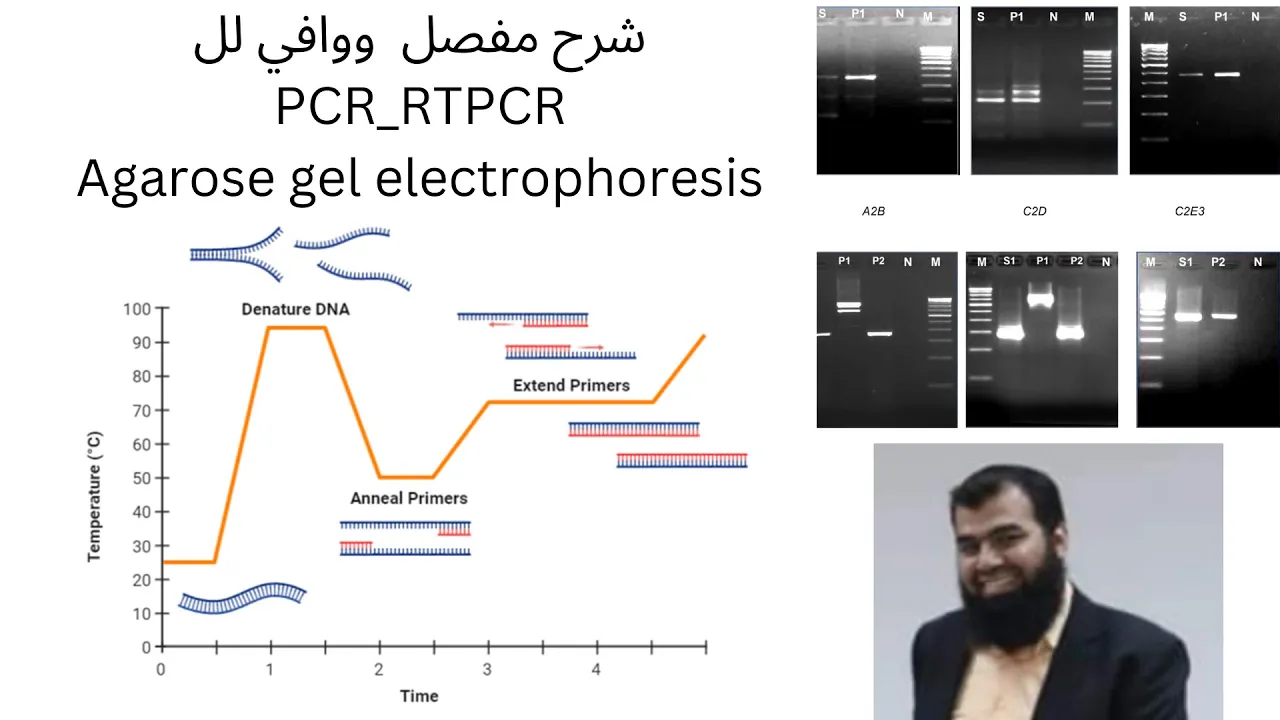 PCR, RT PCR and Agarose gel electrophoresis