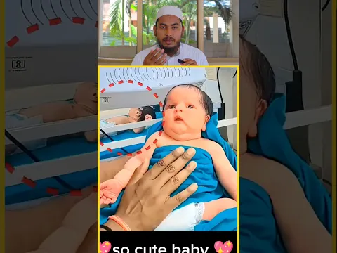 ये बच्चा पैदा होते ही दुनिया के लोगों को किस 😱