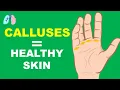 Why do we get calluses