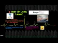 6 Full Django Deployment on Pythonanywhere com