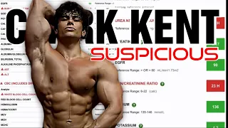 Clark Kent Natty Or Not