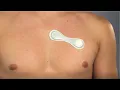 MBS HealthStream Remote Monitoring