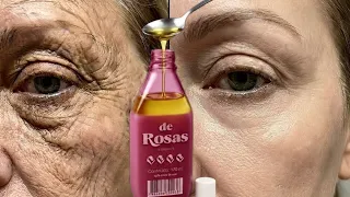 SECOU A BOLSA DOS OLHOS EM 3 Dias! PARECE PLÁSTICA CASEIRA! 