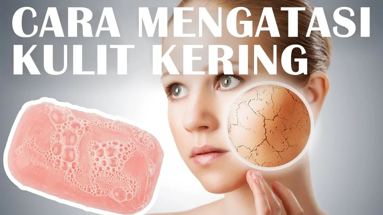 Assalamualaikum.. Semoga bermanfaat yaa tipsnya... Jika ada saran/request komennn yaa...   DISCLAIME. 