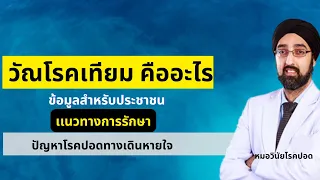 วัณโรคเทียมต้องผ่าตัดไหม