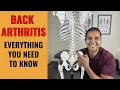 Back Arthritis Everything You Need To Know To Understand And Fix The Root Problem