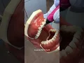 How much of the ultrasonic tip should be touching the tooth