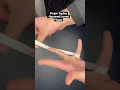 Finger Taping - Sprained Jarred Finger