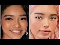 Pasabist Sab Zada surgery exposed lip fillers nose job and more