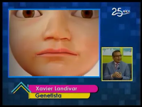 El labio leporino: Causas y tratamietos