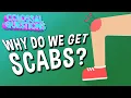 Why Do We Get Scabs COLOSSAL QUESTIONS