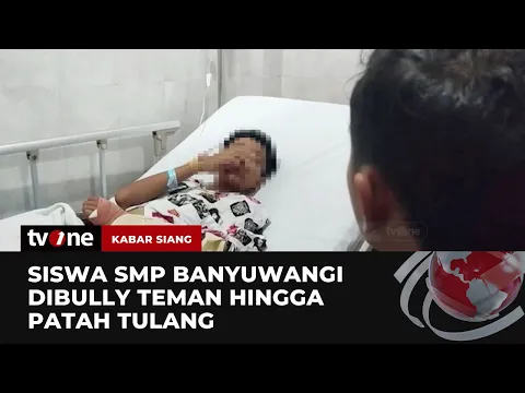 Siswa di Banyuwangi Alami Patah Tulang Akibat Bullying, Disdik Minta Keterangan Pihak Sekolah