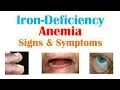 Download Lagu Iron-Deficiency Anemia Signs \u0026 Symptoms (ex. Fatigue, “Spoon Nails”, Cracked Lips)
