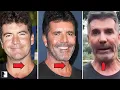 Simon Cowell s Transformation Explained by a Facial Surgeon