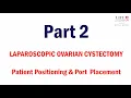 Laparoscopic Ovarian Cystectomy I Patient Positioning Port Placement Part 2