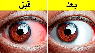 إليك     تمارين سهلة لإراحة العيون المتعبة دندنها