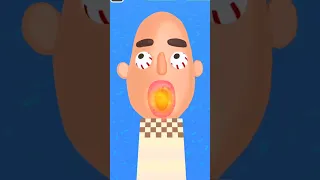 سويتله لفه ام فلغل حار ضل يطلم العاب افلام كارتونيه دكتور عمليات مضحك 