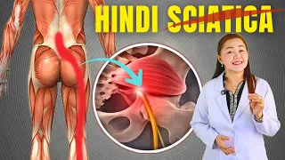 "AKALA MO SCIATICA? Itong Maliit na Muscle Pala ang May Kasalanan" Doc Cherry