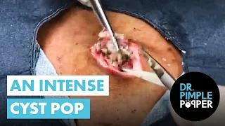You Won t Believe This Pop