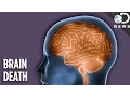 Is A Brain Dead Person Actually Dead