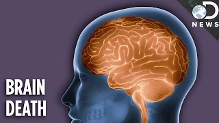 هل الشخص المصاب بموت دماغي ميت حقا   دندنها