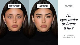 Why the Eyes Make or Break a Face (And How to Fix Yours)