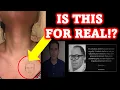 UNBELIEVABLE TATTOO OF BRYAN KOHBERGER FACE WOMAN IN LOVE AND SUPPORT GROWS ON FACEBOOK