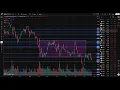 PFE Stock Pfizer stock analysis PFE STOCK PREDICTION analysis news today
